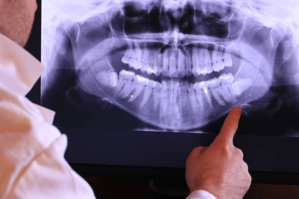 Best Broken or Chipped Tooth Repair in Montura, FL